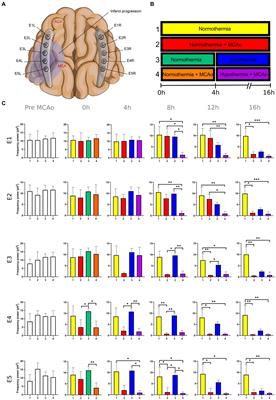 The neurophysiological effect of mild hypothermia in gyrencephalic brains submitted to ischemic stroke and spreading depolarizations